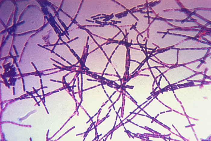 Bacillus_anthracis_Gram.jpg