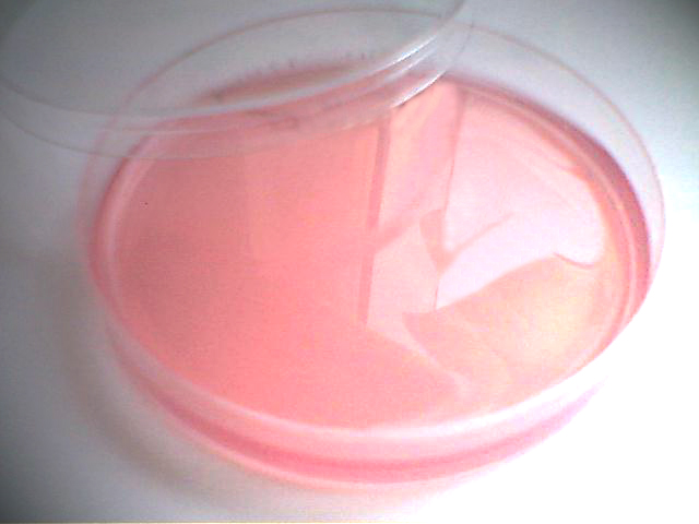 Endo-Agar[1].jpg