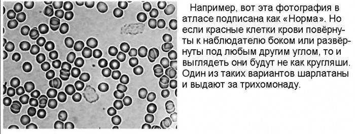 ''Гемосканирование''_05_Норма.jpg