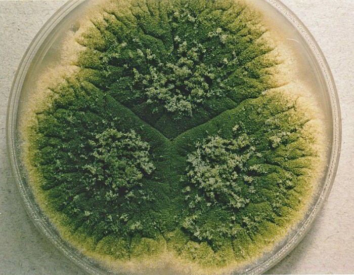 Aspergillus_parasiticus_UAMH3108.jpg