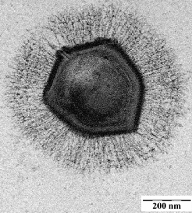 Electron_microscopic_image_of_a_mimivirus_-_journal.ppat.1000087.g007_crop.png
