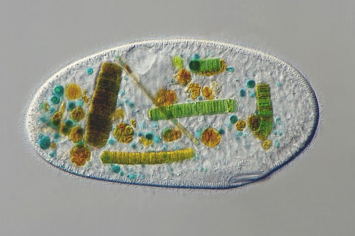 The_ciliate_Frontonia_sp.jpg